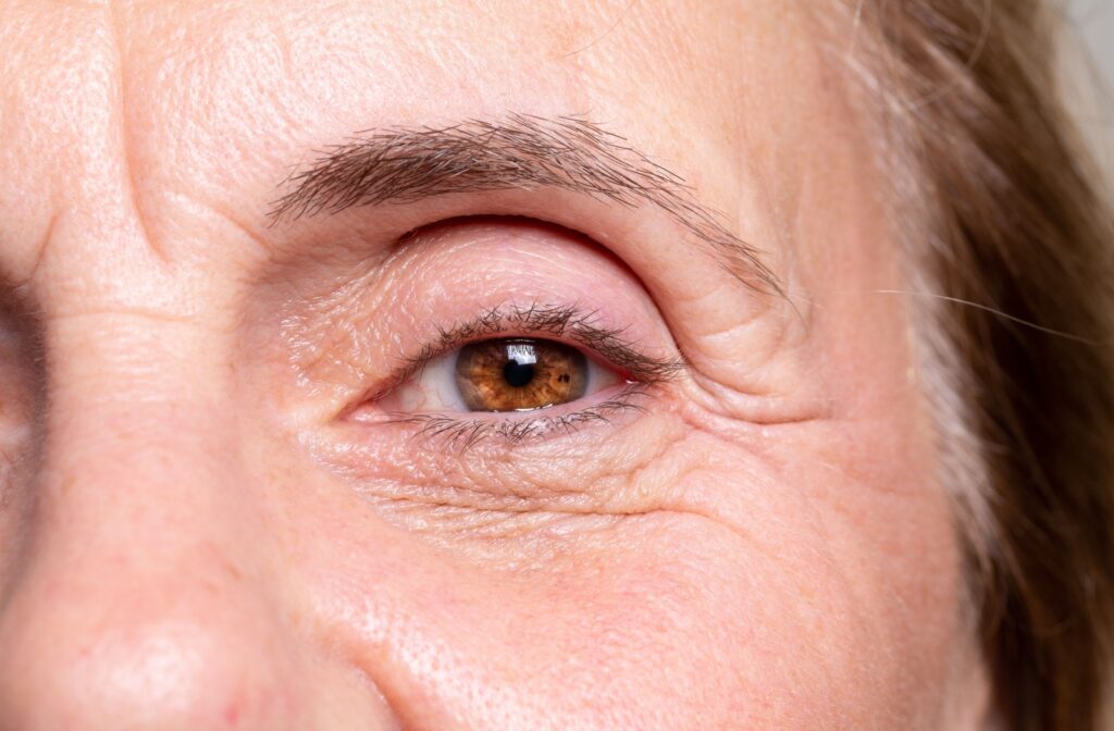 Close up of a persons eye and the wrinkles that surround the delicate skin around the eye